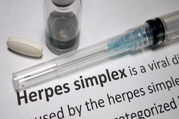 The latest research says herpes virus goes On and Off